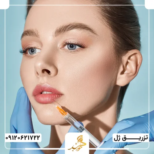 نقش فرم کلی لب در تعیین میزان ژل مورد نیاز برای تزریق