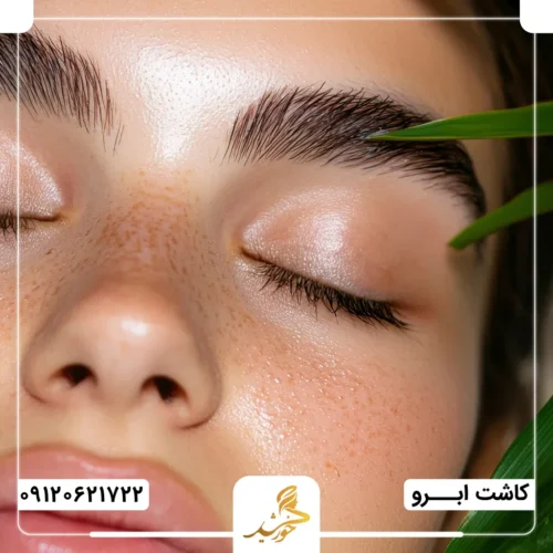 کاشت ابرو به روش FUT در کلینیک زیبایی خورشید