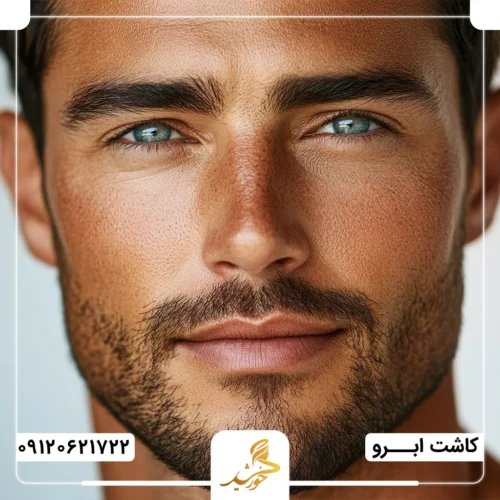 کاشت ابرو مردانه در کلینیک تخصصی خورشید