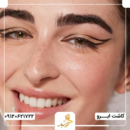 کاشت ابرو و ارائه مراقبت‌های پس از کاشت در کلینیک تخصصی خورشید